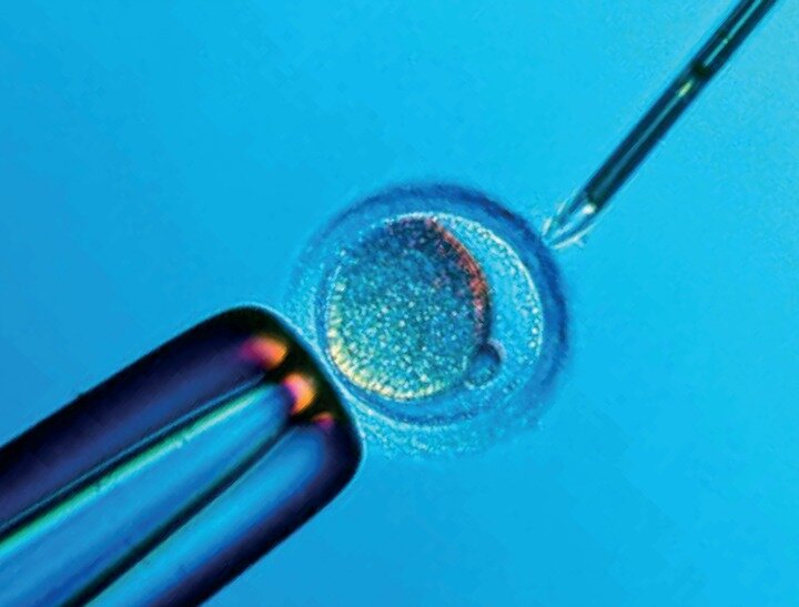 IVF feature